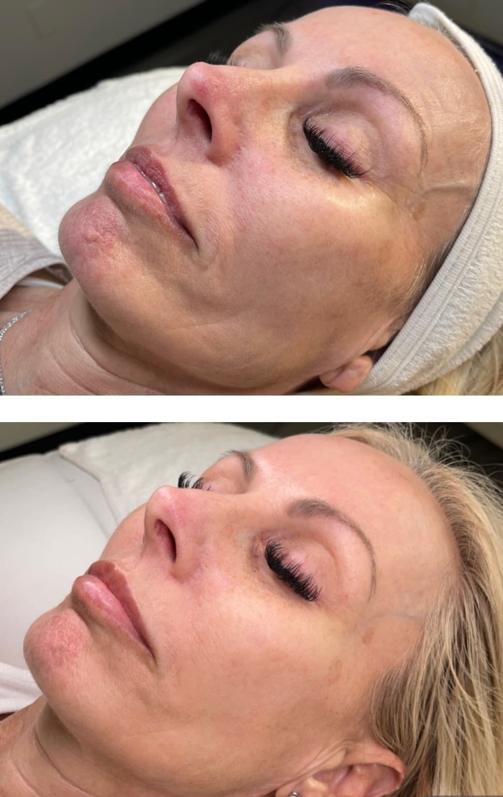 Real client showing mature skin glow improvement after a 3-treatment Procell Microchanneling series at Lovely Lilly's North Austin studio